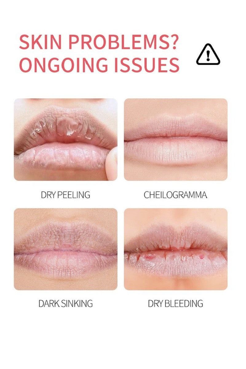 Moisturizing Repair Lip Balm